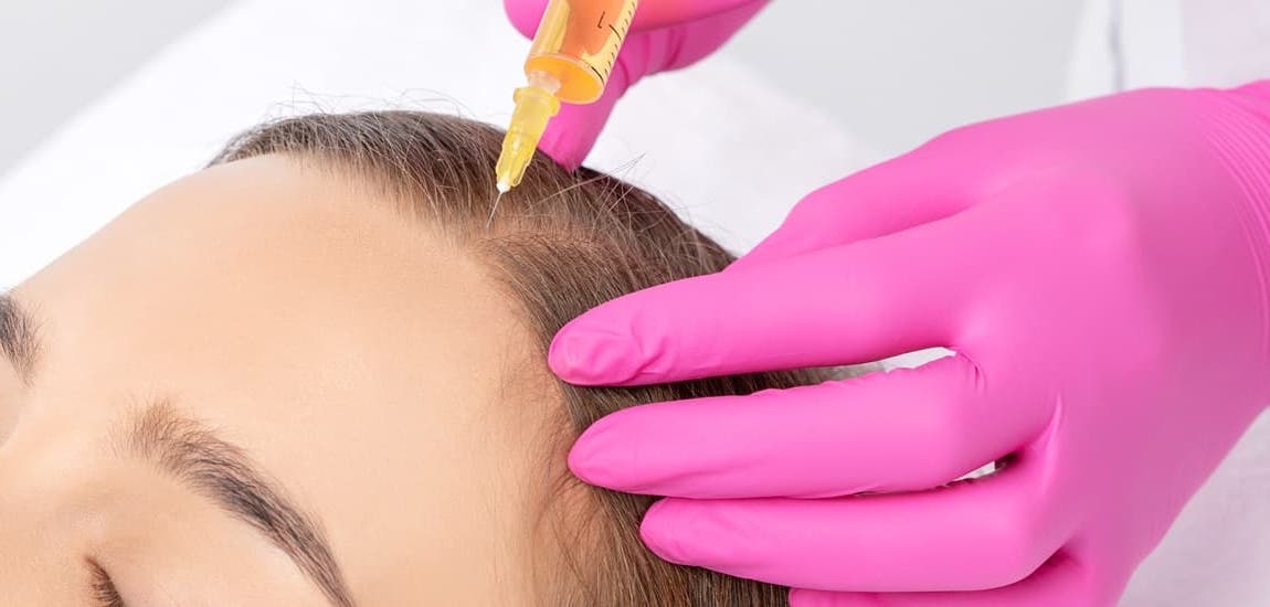 woman receiving prp hair restoration treatment