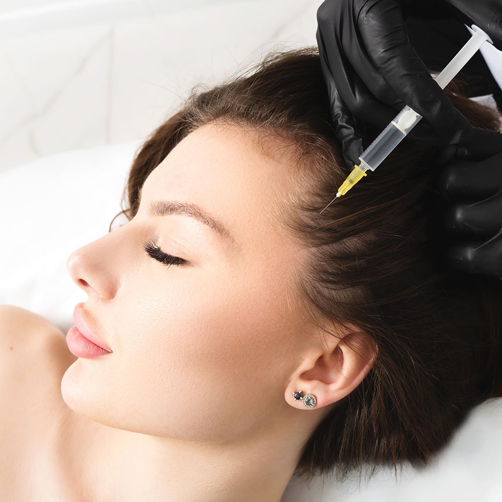 Mesotherapy, vitamin injections in head skin of hair area. Prof